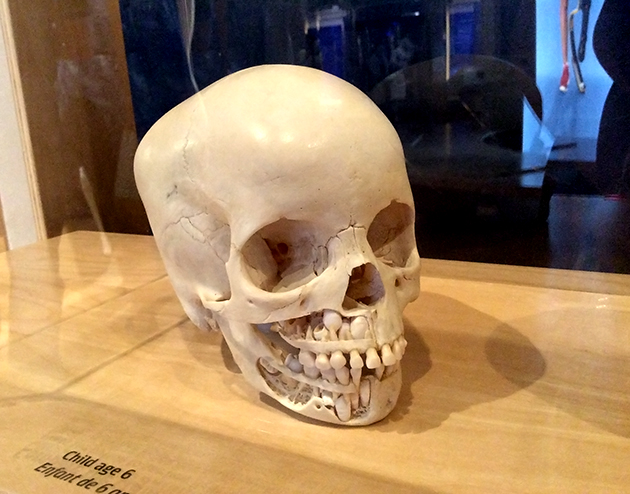 Child's skull